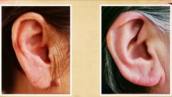 耳朵是身體的“長壽開關”每天揉一揉趕走小毛病