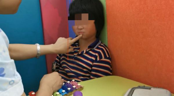 案例：9歲無發音、無語言的女孩，訓練後主動語言增多，對答如流