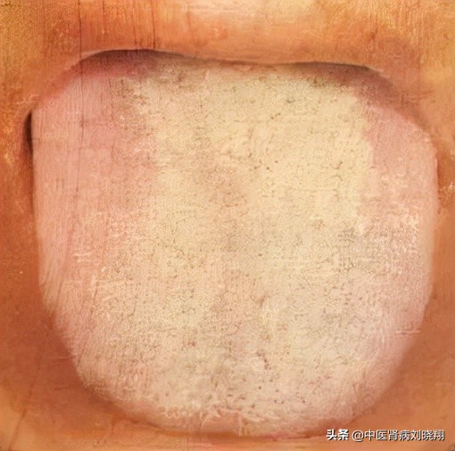 劉主任讓病人伸舌頭，看的是什麼？