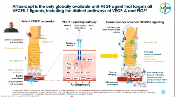 探索視網膜醫療的地平線：EURETINA中的視網膜疾病新篇章