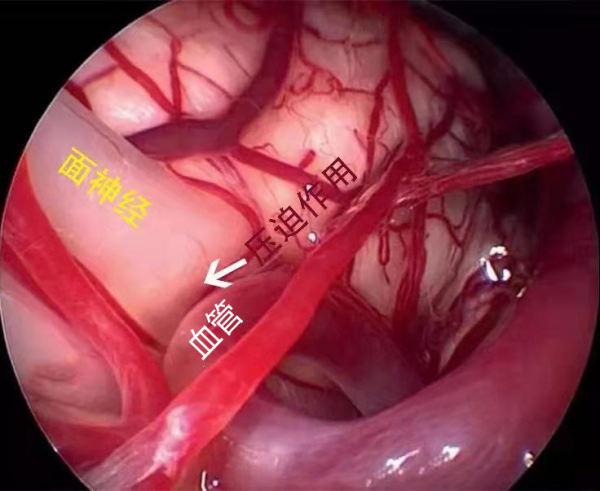 為什麼醫生告訴我左眼皮跳跳不是好事？