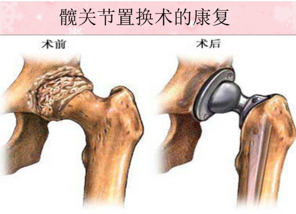 生啃手指，徒手拔牙，戳瞎眼睛，沒有疼痛的世界究竟有多可怕？