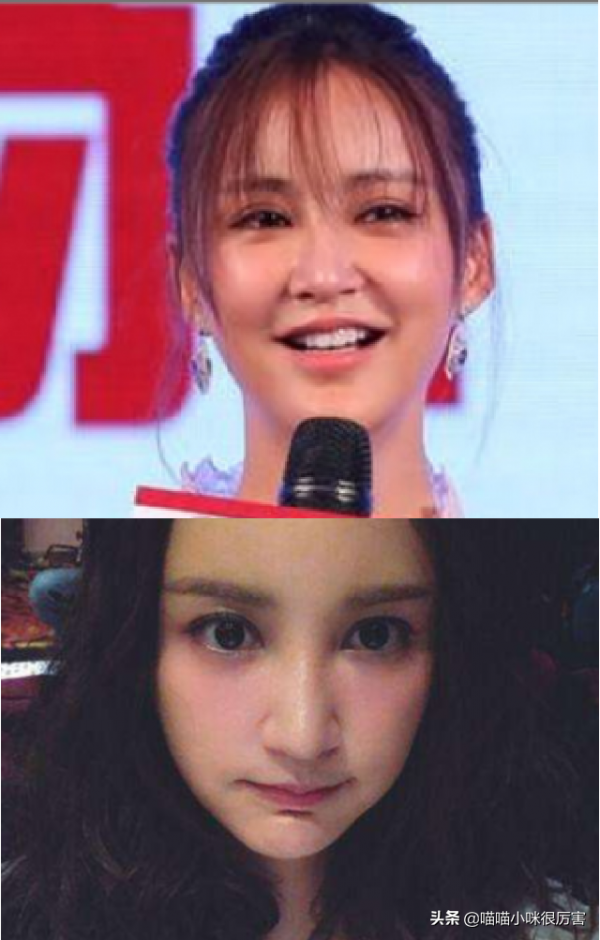 整形演員的春天要結束了?滿屏塑膠臉、人造臉該消停了 整形演員的春天要結束了?滿屏塑膠臉、人造臉該消停了