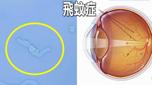 醫生坦言：很多病其實並不是病，只是人老了而已，或無需過度治療