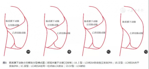 直腸癌根治術中解剖學爭議探討
