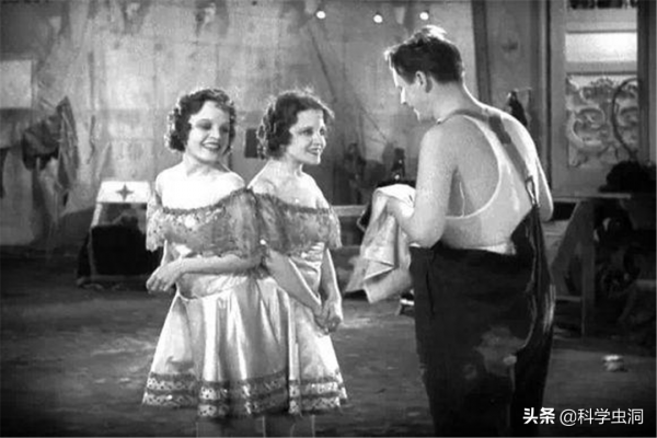 連體人一個去世怎麼辦？連體姐姐死後，妹妹被迫和遺骸生存2天