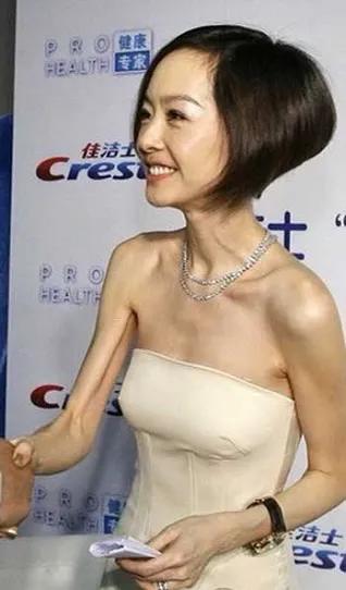 瘦成“紙片人”的5位明星，各有各的辛酸，混娛樂圈怎麼那麼難