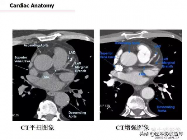 CT斷層解剖圖譜最全總結「推薦收藏」 CT斷層解剖圖譜最全總結「推薦收藏」