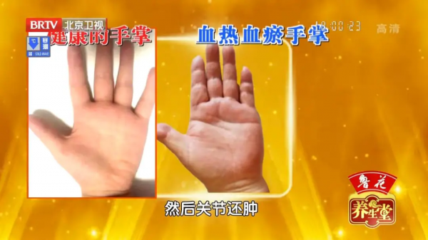 體內有水溼、血瘀，手舌會有這些特點！學會兩個簡單食療方來調理