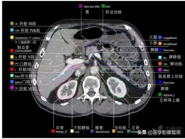 CT斷層解剖圖譜最全總結「推薦收藏」 CT斷層解剖圖譜最全總結「推薦收藏」