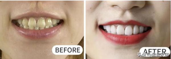 為什麼每天早晚刷兩次牙，牙齒還是會變黃呢？