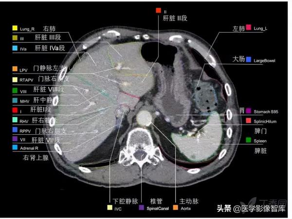 CT斷層解剖圖譜最全總結「推薦收藏」 CT斷層解剖圖譜最全總結「推薦收藏」