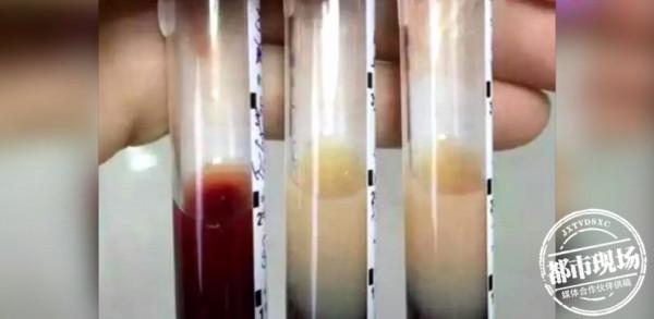 一晚連吃十盤肉，女子差點丟了命