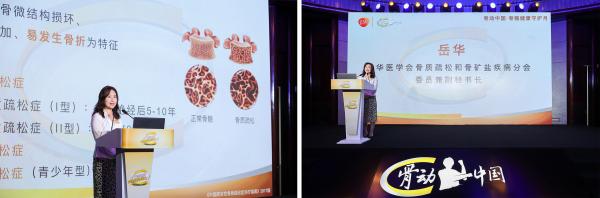 郎平卸任後首度亮相，“鐵榔頭”呼籲骨骼健康，“年輕人少打遊戲多戶外運動”