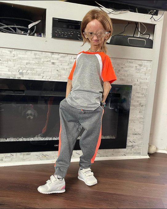 知名網紅阿達莉亞·羅斯因早衰症去世，年僅15歲，家人公佈死訊