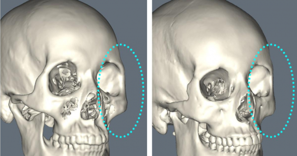 “假臉”大比拼?薛之謙變化大、羅志祥五官前後對比驚人 “假臉”大比拼?薛之謙變化大、羅志祥五官前後對比驚人