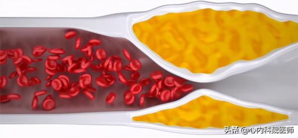 心血管患者吃他汀，血脂已經正常，可以減半服用嗎？