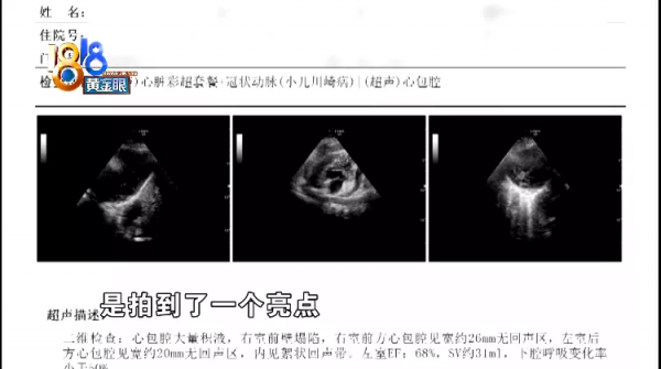 金屬絲劃破孩子心臟，家長推測“鋼絲刷”