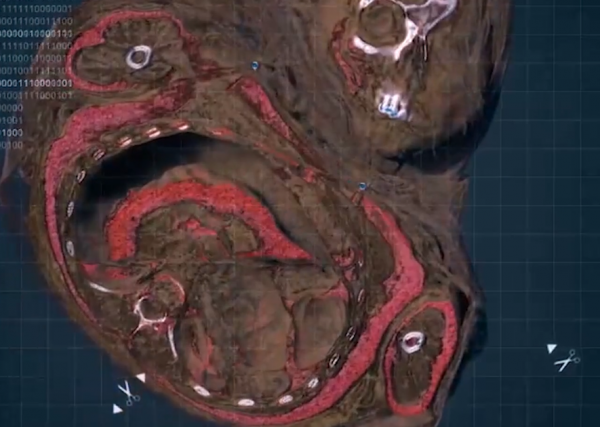 1999年,考古隊登6700米山頂,發現冰凍500年少女,面貌完好彷彿睡著 1999年,考古隊登6700米山頂,發現冰凍500年少女,面貌完好彷彿睡著