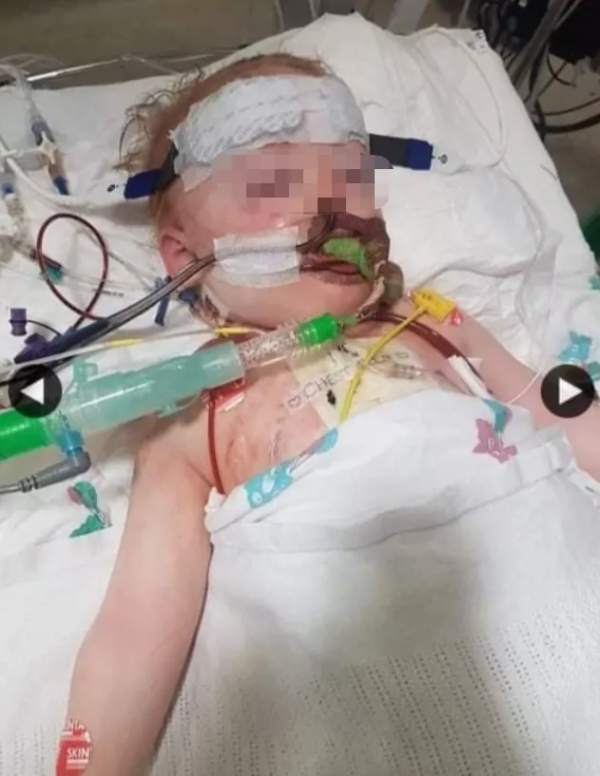 心痛！英國2歲嬰兒誤吞電池去世，心臟被燒破洞