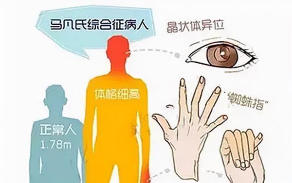 9年前“小姚明”張佳迪逝世，郭士強痛哭惋惜，其骨灰撒向了大海