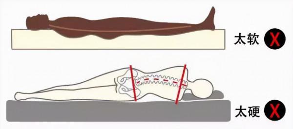 腰椎間盤突出，怎麼躺比較好？醫生教你3種睡姿，健康又舒服