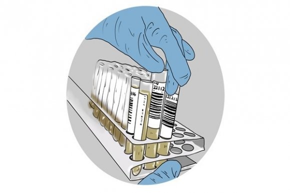 吃洋蔥可以提高人體免疫力？免疫力也會衰老，需利用正確方法提高