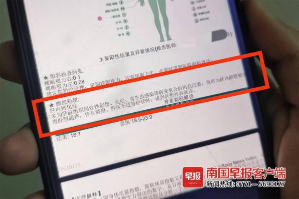 體檢查出肝內鈣化灶！醫生：不必過慮，定期檢查即可