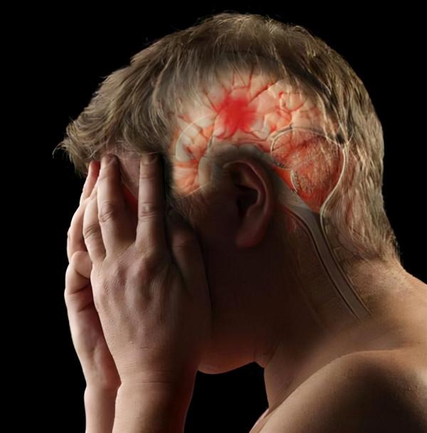 腦梗來臨，睡覺先知？提醒：睡覺出現5個跡象，或是腦梗前的預警