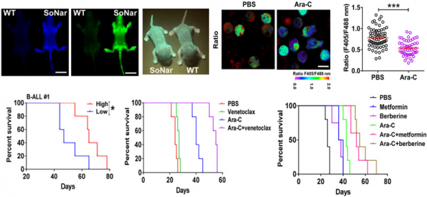 B細胞急性淋巴細胞白血病治療研究獲新進展 B細胞急性淋巴細胞白血病治療研究獲新進展