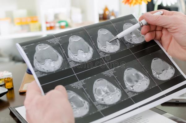 核磁共振結果更為精準清晰,但很多醫生不推薦去做,這是為什麼? 核磁共振結果更為精準清晰,但很多醫生不推薦去做,這是為什麼?