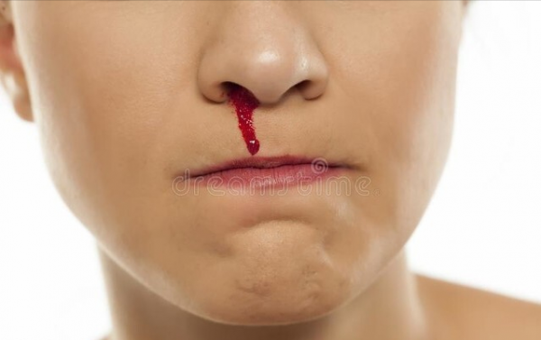 冬季換季,中老年人有腦血栓風險,5個訊號徵兆,這個提醒很及時 冬季換季,中老年人有腦血栓風險,5個訊號徵兆,這個提醒很及時