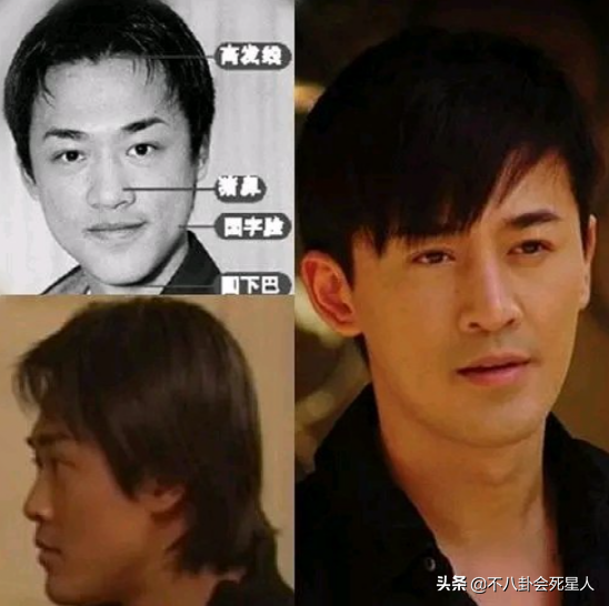 TVB藝人不愛整容，但這5位演員“換頭逆襲”，林峰、劉愷威都在列
