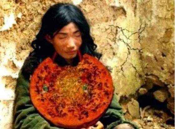 我被父母養成河南第一懶人：7歲不會走路，吃飯靠喂23歲自己餓死