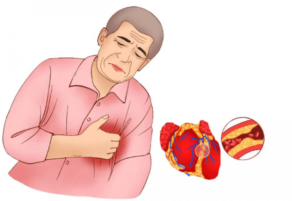 花生油、菜籽油、玉米油,哪種油更健康?提醒:這2種油儘量少碰 花生油、菜籽油、玉米油,哪種油更健康?提醒:這2種油儘量少碰
