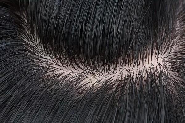 戴假髮需要注意什麼?假髮的常見問題 戴假髮需要注意什麼?假髮的常見問題