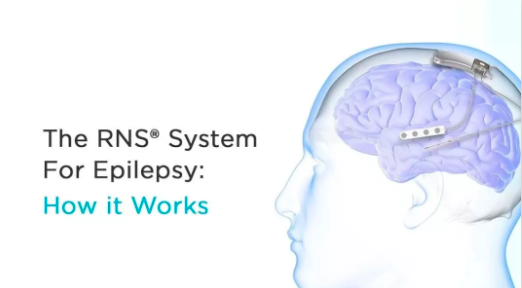用晶片扼殺食慾，從源頭解決肥胖問題