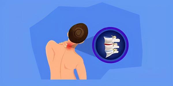 一扭脖子咔咔響，是怎麼回事？