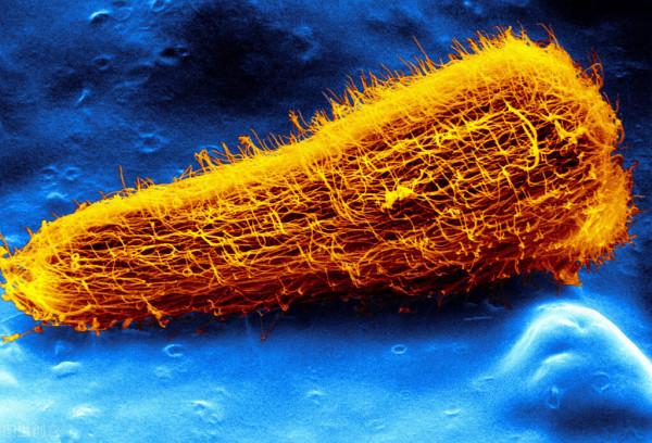 一口白酒一口魚生能殺蟲？34歲男子手術後肝臟裡接連爬出肝吸蟲