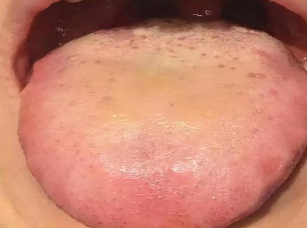 白天調陰陽,晚上安神!教你3個治療失眠的調理小方 白天調陰陽,晚上安神!教你3個治療失眠的調理小方