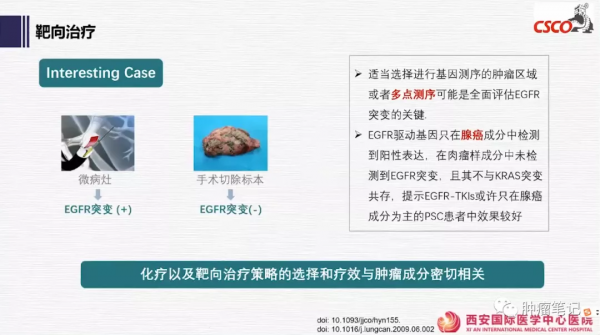 肺肉瘤樣癌治療進展