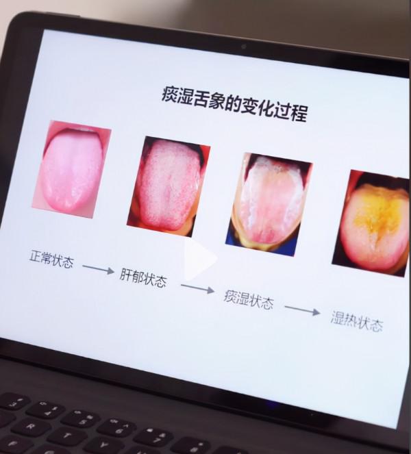 人人學中醫舌診，幾種最常見的舌診，趕緊收藏起來