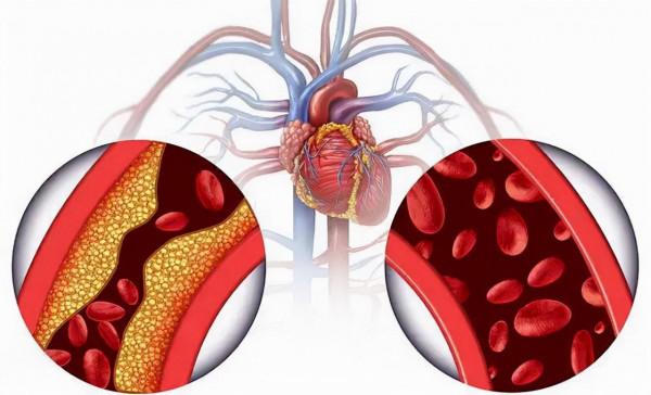 科普｜冬天要合理膳食，謹防高同型半胱氨酸血癥對人的危害