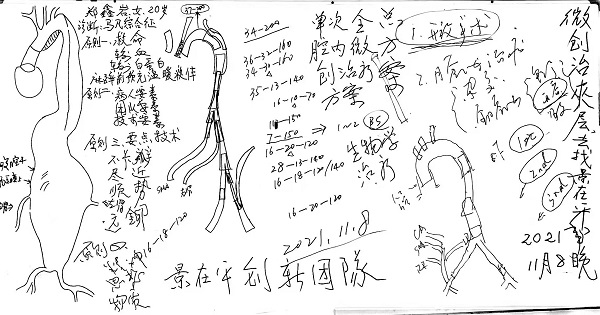 術前制定127個步驟，世界級微創技術讓馬凡女孩重生