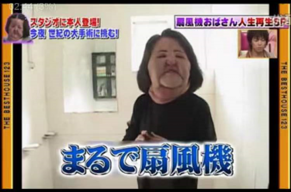 “整容上癮”韓慧景：把臉整成電風扇，自行注射食用油，代價慘痛