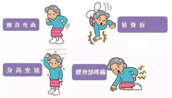 對付骨質疏鬆症——更年期婦女，更要“硬”骨頭