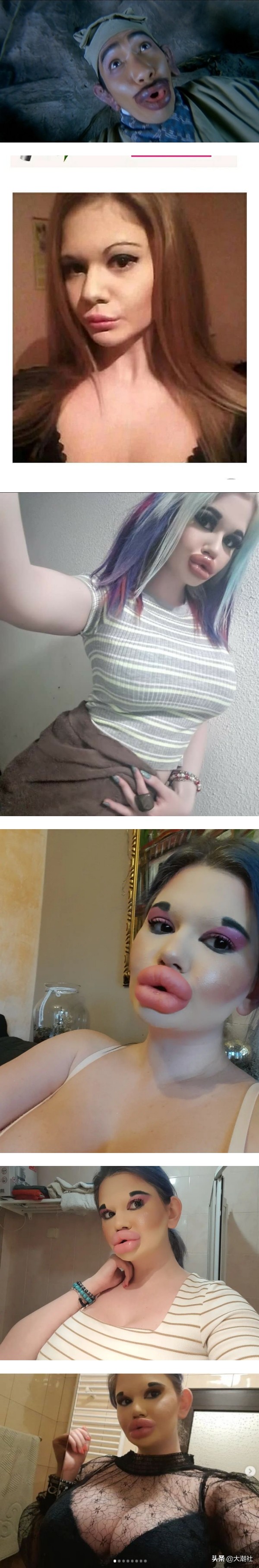 清純網紅整出世界第一豐唇！梁朝偉《東成西就》香腸嘴竟然成真？