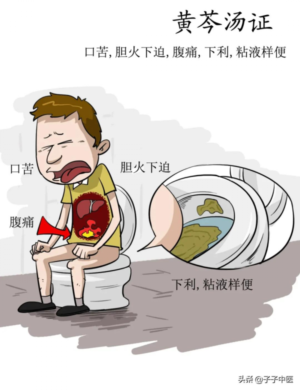 全本《傷寒論》高畫質漫畫版——簡單、好看、好掌握 全本《傷寒論》高畫質漫畫版——簡單、好看、好掌握