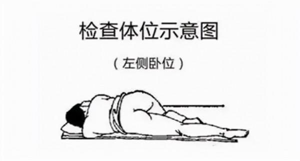 肛腸檢查:你到底在怕什麼 肛腸檢查:你到底在怕什麼