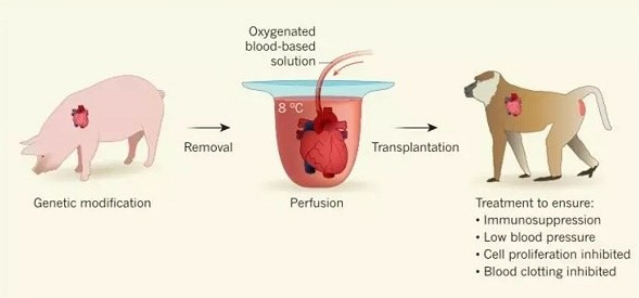 1984年,美國母親為給初生女兒續命,冒險移植狒狒心臟,最後怎樣了? 1984年,美國母親為給初生女兒續命,冒險移植狒狒心臟,最後怎樣了?